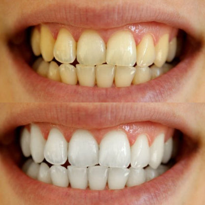 BRIGHTY™ Bandes blanchissantes