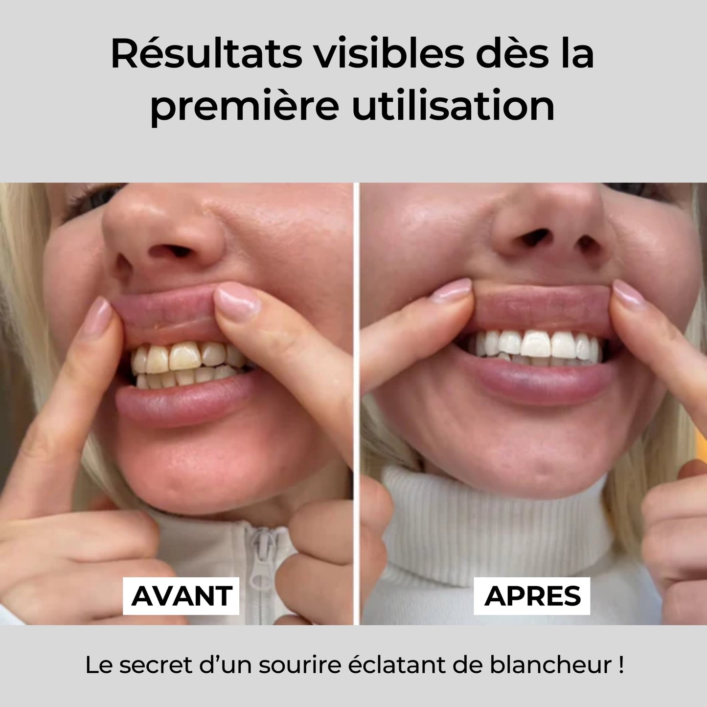 BRIGHTY™ Bandes blanchissantes